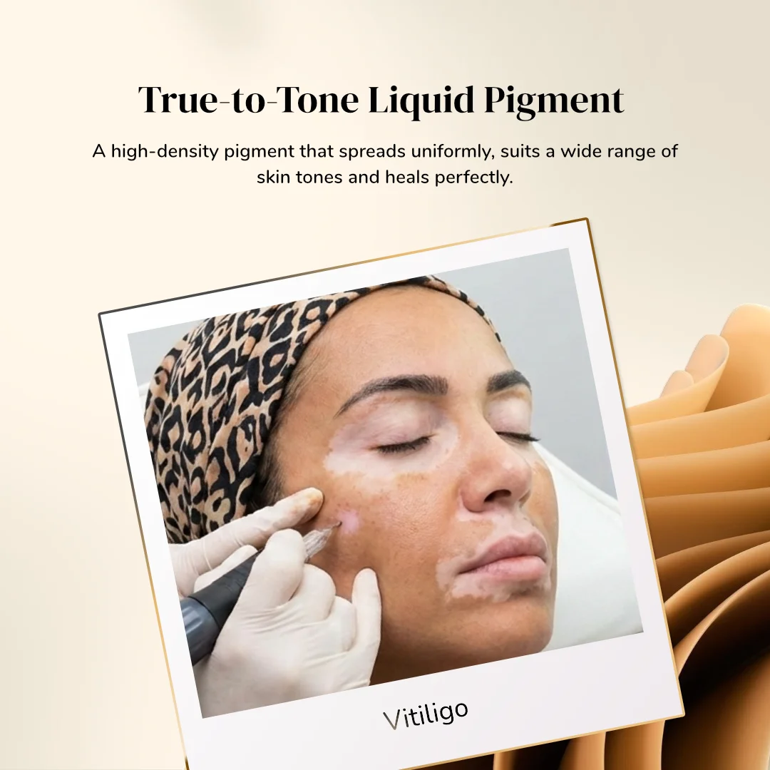 ibrow Vit Spice Premium Liquid Pigment for Vitiligo Camouflage – 5ml - Image 2